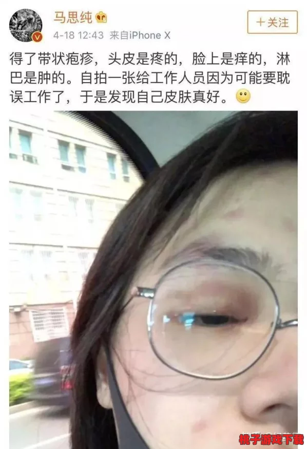 “岳下面白嫩肥厚，网友热评：这才是完美的肌肤状态，让人忍不住想要亲近！”